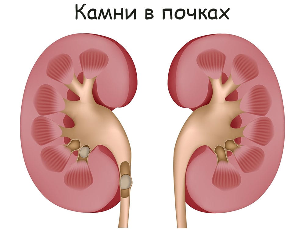 Картинка кракен маркетплейс